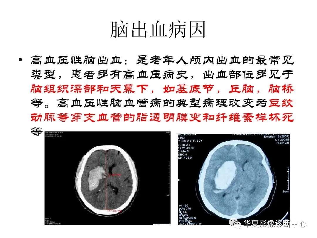 皮肤淀粉样变最新疗法，突破与创新研究揭秘